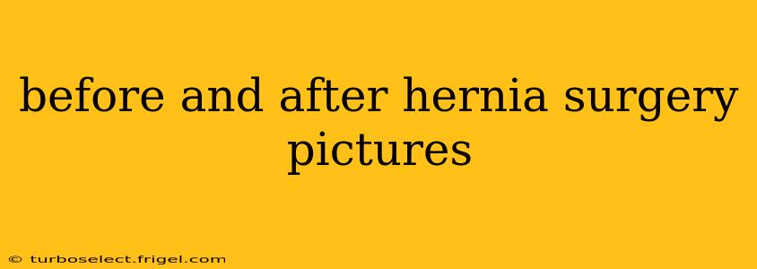 before and after hernia surgery pictures