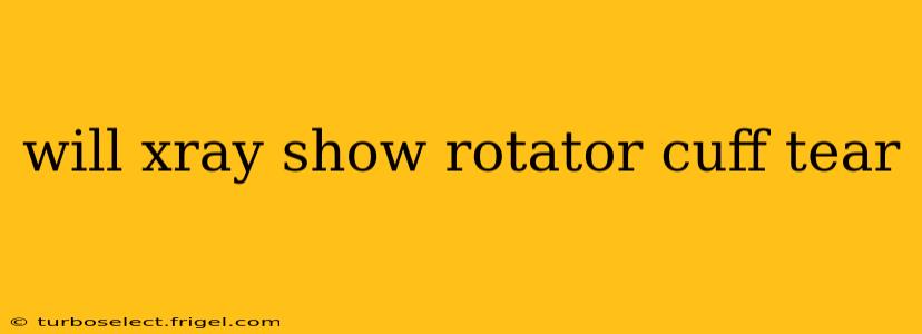 will xray show rotator cuff tear